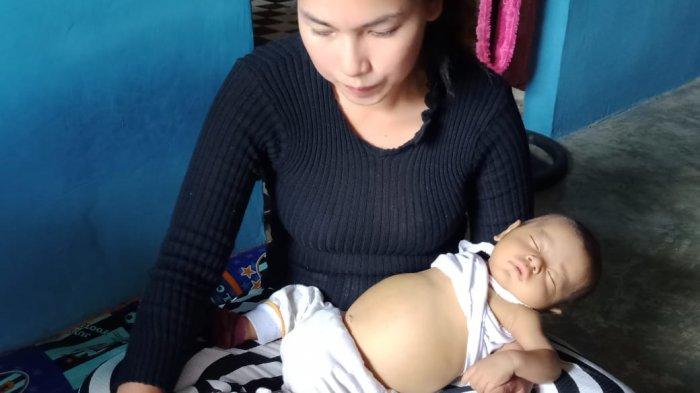 Butuh Bantuan, Bayi Lima Bulan di Karimun Didiagnosis Alami Kerusakan Hati