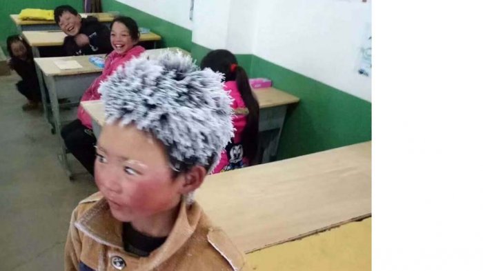 Bocah Ini Viral dengan Rambut Putih dan Wajah Seperti Boneka. Namun Ada Cerita Getir di Baliknya