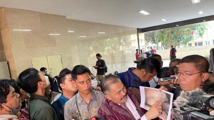 Fakta Baru Kematian Brigadir J, Kuasa Hukum Sebut Sebelum Ditembak Korban Dijerat Tali