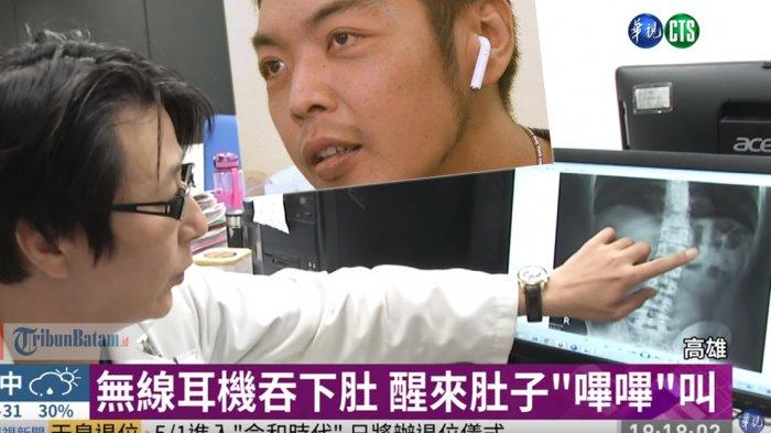 Pria Ini Tidak Sadar Telah Menelan Earbuds, Suara Musik Terdengar dari Perutnya