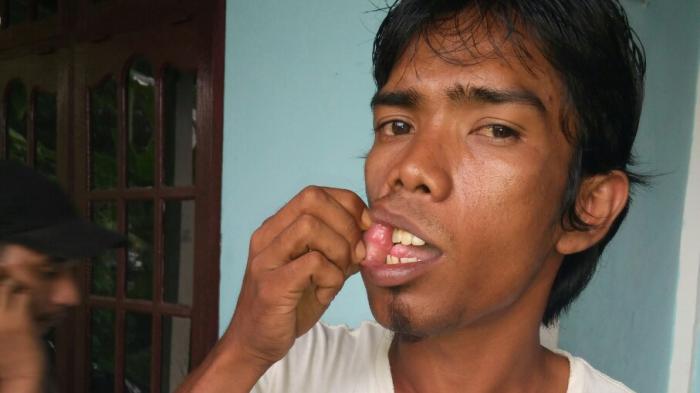 Agar Mengaku Mencuri, Khairul Mengaku Dipukuli dan Diludahi Polisi Meranti