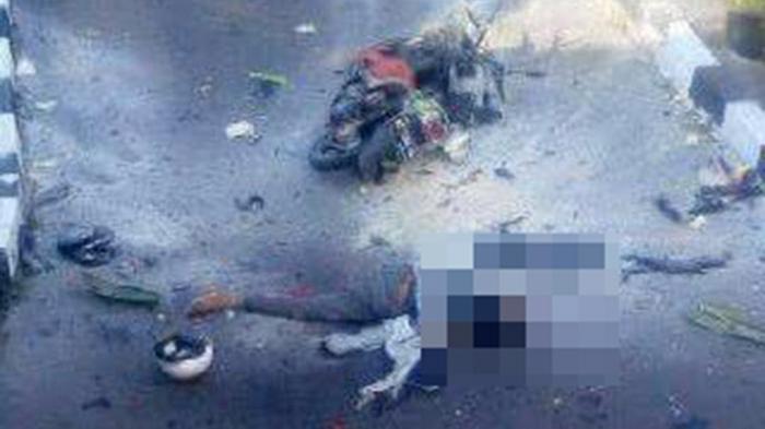 BERITAFOTO: Ini Foto-foto Terduga Pelaku Bom Bunuh Diri di Mapolresta Solo - kondisi-terduga-teroris-yang-melakukan-bom-bunuh-diri-di-mapolresta-solo2_20160705_135150.jpg