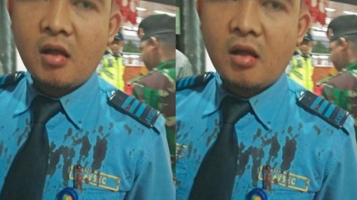 VIRAL! Petugas Avsec Lagi-lagi Kena Bogem Mentah hingga Bengkak dan Berdarah