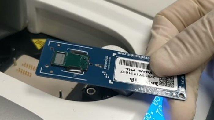 Deteksi Covid-19, Ini Alat Tes Virus Corona yang Dipakai Singapura dan Jepang