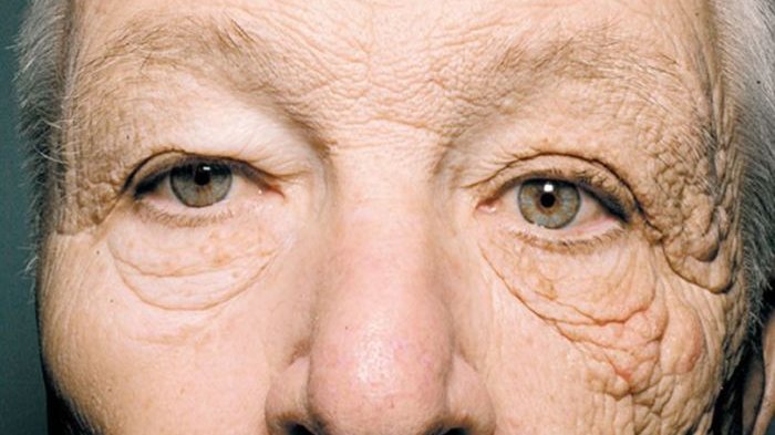 MENGEJUKAN, Wajah Pria Ini Retak-Retak Setelah 28 Tahun Jadi Sopir Truk. Penyebabnya adalah Matahari