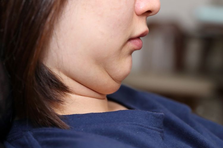 3 Tips Menghilangkan Double Chin Secara Alami
