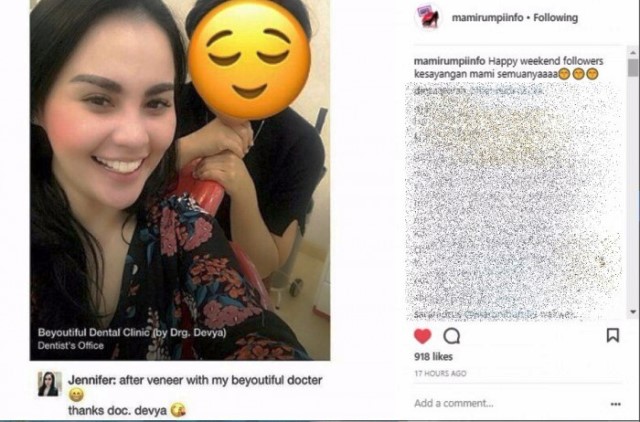 Cuek Dicemooh, Jennifer Dunn Pamer Gigi Veneer. Kata Netter 'Tepok Jidat Inggrisnya Belepotan'