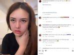 Amanda-Manopo-dikabarkan-sakit-gigi-sata-live-tiktok.jpg