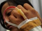 Bunga Siswi SMK di Bandung Keracunan Makanan dan Meninggal Dunia, Matanya Melotot Mulut Berbusa