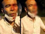 foto-awalluddin-rao-dengan-mata-berdarah-darah.jpg