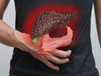 ilustrasi-hepatitis-disebabkan-oleh-virus-dan-gaya-hidup-yang-tidak-sehat.jpg