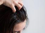ilustrasi-ketombe-cara-alami-hilangkan-ketombe.jpg