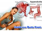 ilustrasi-penderita-usus-buntu_20160623_143854.jpg