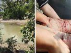 kaki-remaja-terluka-digigit-buaya-di-sungai.jpg