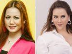 nita-thalia-rela-habis-uang-1-miliar-untuk-operasi-plastik-total.jpg
