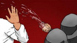 Ilustrasi-Disiram-air-keraspenyiraman-air-keras.jpg