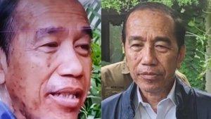 Jokowi-alergi-kulit.jpg
