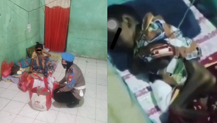 Terjangkit HIV, Balita di Muaragembong Wajib Minum Obat Seumur Hidup, Jika Tidak, Ini Risikonya
