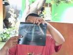 Rahang Patah Akibat Bullying, Polisi Tetapkan 1 Tersangka dan 4 ABH di SMKN 1 Cikarang Barat