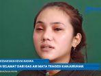 Kevia-Naswa-korban-selamat-tragedi-Stadion-Kanjuruhan.jpg