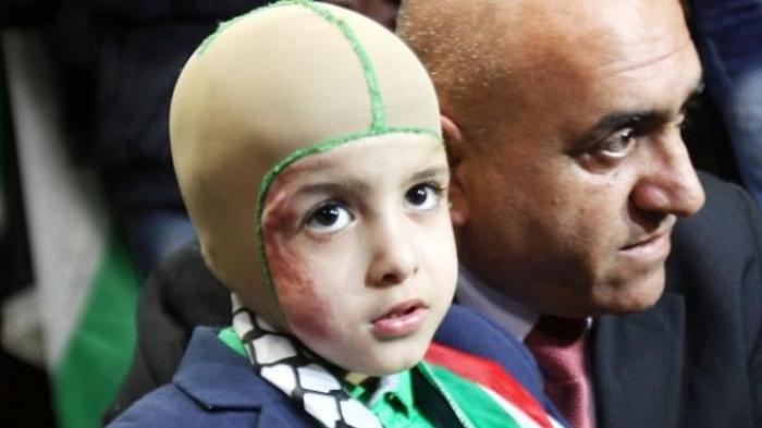 Zidane Disebut Wujudkan Mimpi Bocah Korban Bom Palestina Bertemu Pemain Madrid