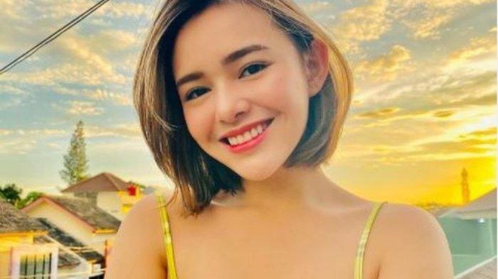 Lebih Tebal, Bibir Amanda Manopo Jadi Omongan Netizen Seusai Suntik Dagu dan Vitamin C