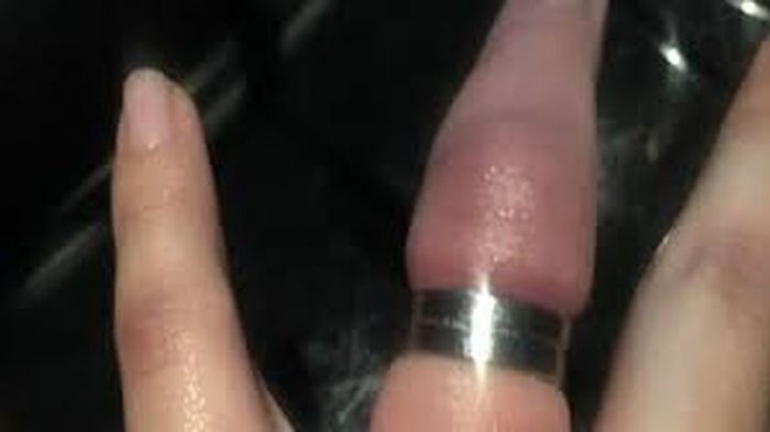 Cincin Kawin Berakhir Petaka, Beralasan Latihan Drama, Sudah 9 Korban Hingga Nyaris Diambil Tindakan