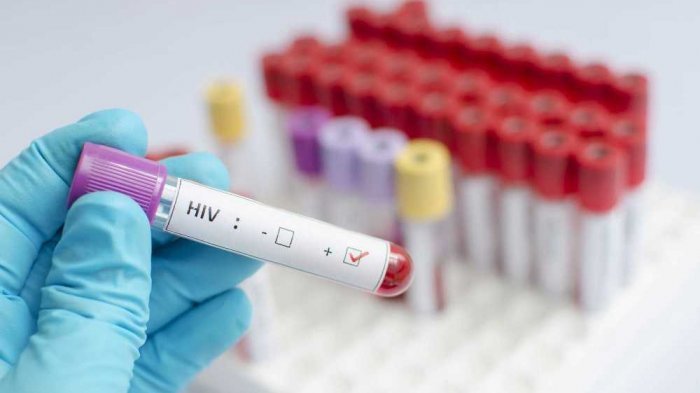 Pria Ini Sengaja Tularkan Virus HIV/AIDS Kepada Wanita yang Diajaknya Kencan