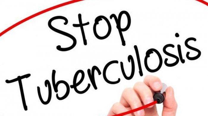 658 Warga Bangka Menderita TBC, Suspek Paling Banyak Ditemukan di Daeah Padat Penduduk