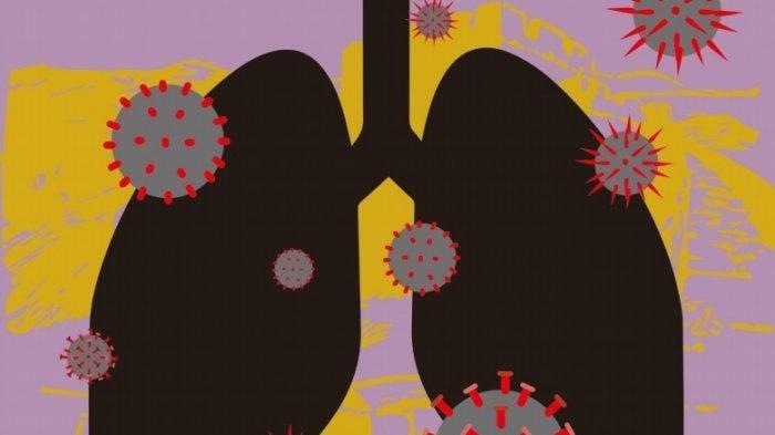 Update Covid-19 di Bangka Belitung, Pasien Positif Bertambah 19, Angka Tertinggi Sejak Januari