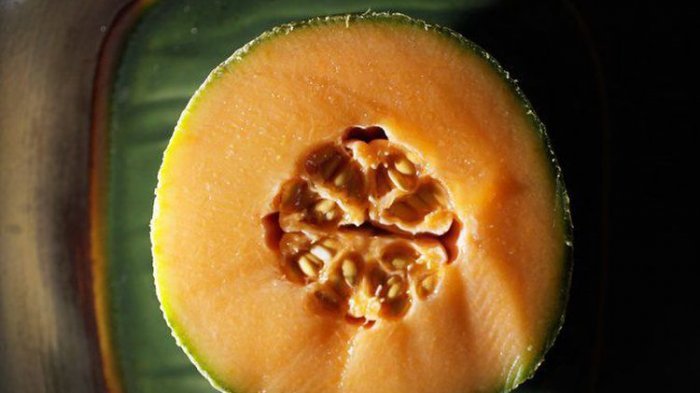 Seperti Ini Gejala Korban Tewas Terinfeksi Bakteri Ganas Listeria dari Rock Melon Austraslia