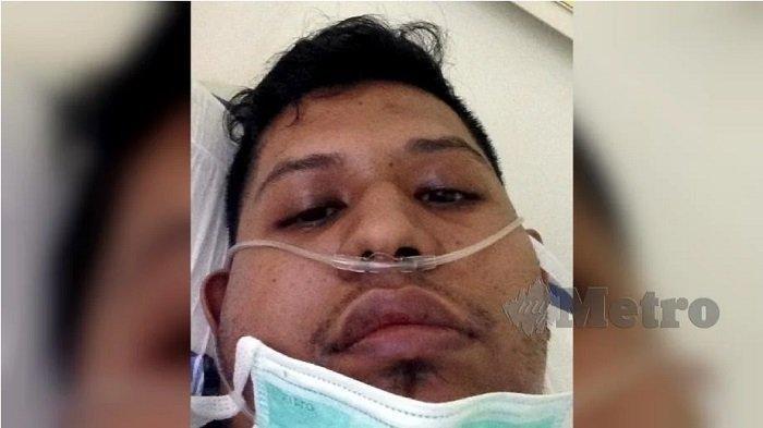 Kisah Pasien Corona, Nafas Seperti Dicabut, Amal Saya tidak Cukup untuk Menghadap Sang Ilahi