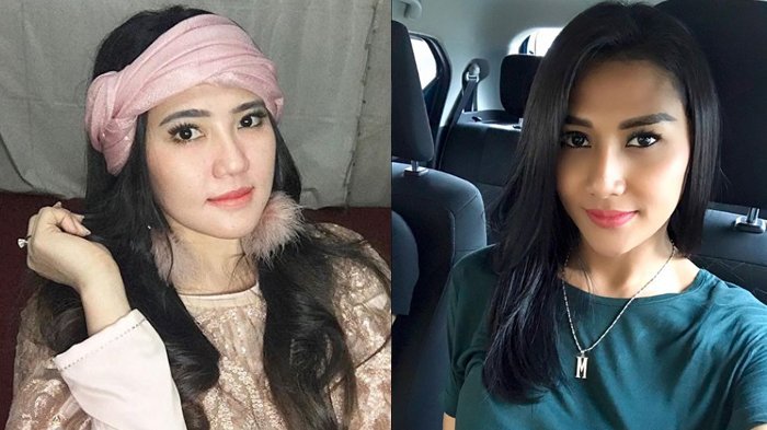 Melly Bradley Sebut Via Vallen Pencitraan Netizen Soroti Kelakuannya yang Cari Sensasi