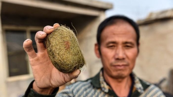 Pria Ini Jadi Kaya Mendadak Tak Sengaja Temukan Empedu Babi Miliknya