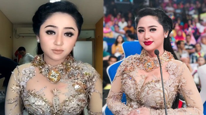 Tanda Merah di Dada Dewi Perssik Bikin Geger Netizen, Cermati Postingannya Ini!