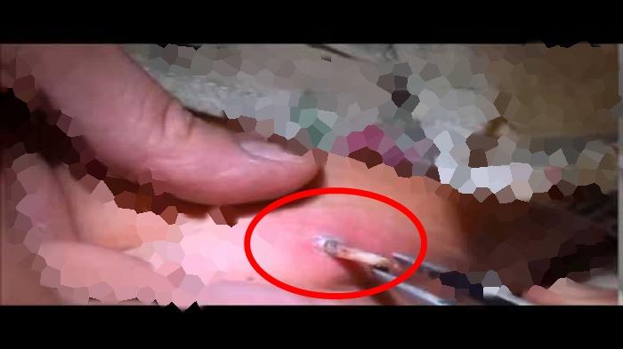 Gantilah Pakaian Dalam Anda, Jika tak Mau Seperti Ini Mengerikan!