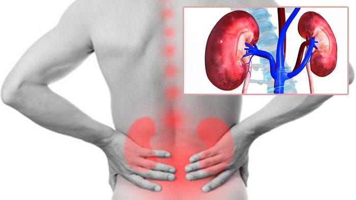 pinggang-dan-ginjal_20170321_222848.jpg