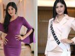 Biodata Erina Gudono, Wanita Cantik Calon Istri Kaesang Pangarep Putra Presiden Jokowi