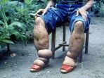 kaki-gajah_20171006_190841.jpg