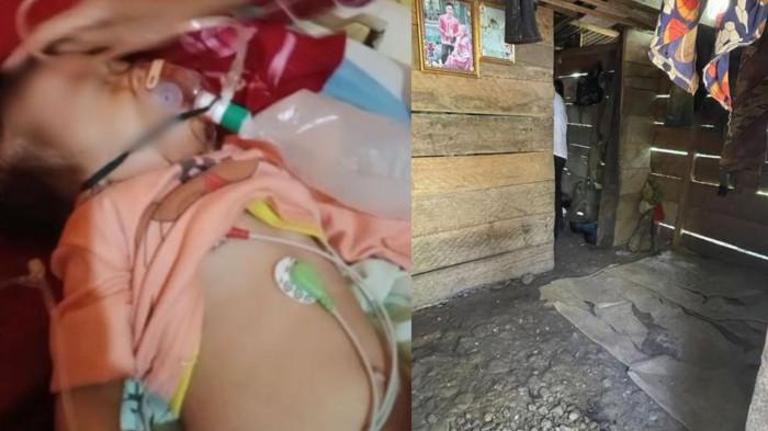 Balita Kakak Beradik di Seluma Terinfeksi Cacing, Gubernur Helmi Gratiskan Pengobatan & Bedah Rumah