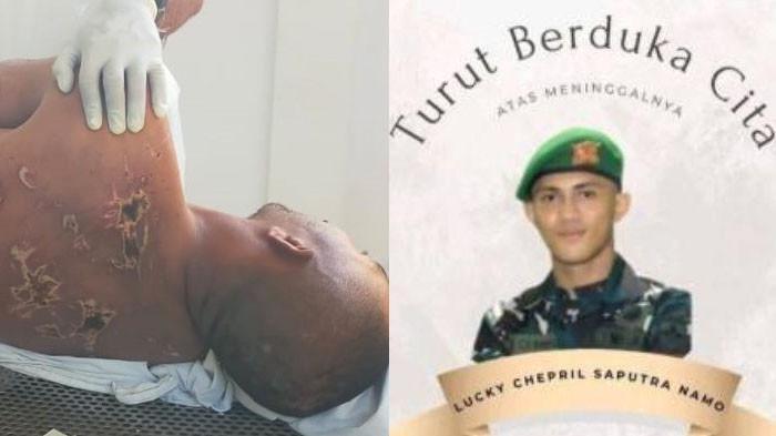 BEKAS LUKA - Prajurit TNI Prada Lucky Namo tewas dianiaya seniornya. Tampak bagian belakang tubuhnyadipenuhi bekas luka.