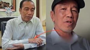 Kondisi-Jokowi-Disorot-Tak-Kunjung-Pulih-Setelah-4-Bulan-Sakit-Sakit-Apa-Sebenarnya.jpg