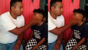 Sosok-JM-Siswa-SMP-di-Buton-Selatan-yang-Mengaku-Dipukul-Guru-Hingga-Alami-Gigi-Patah.jpg