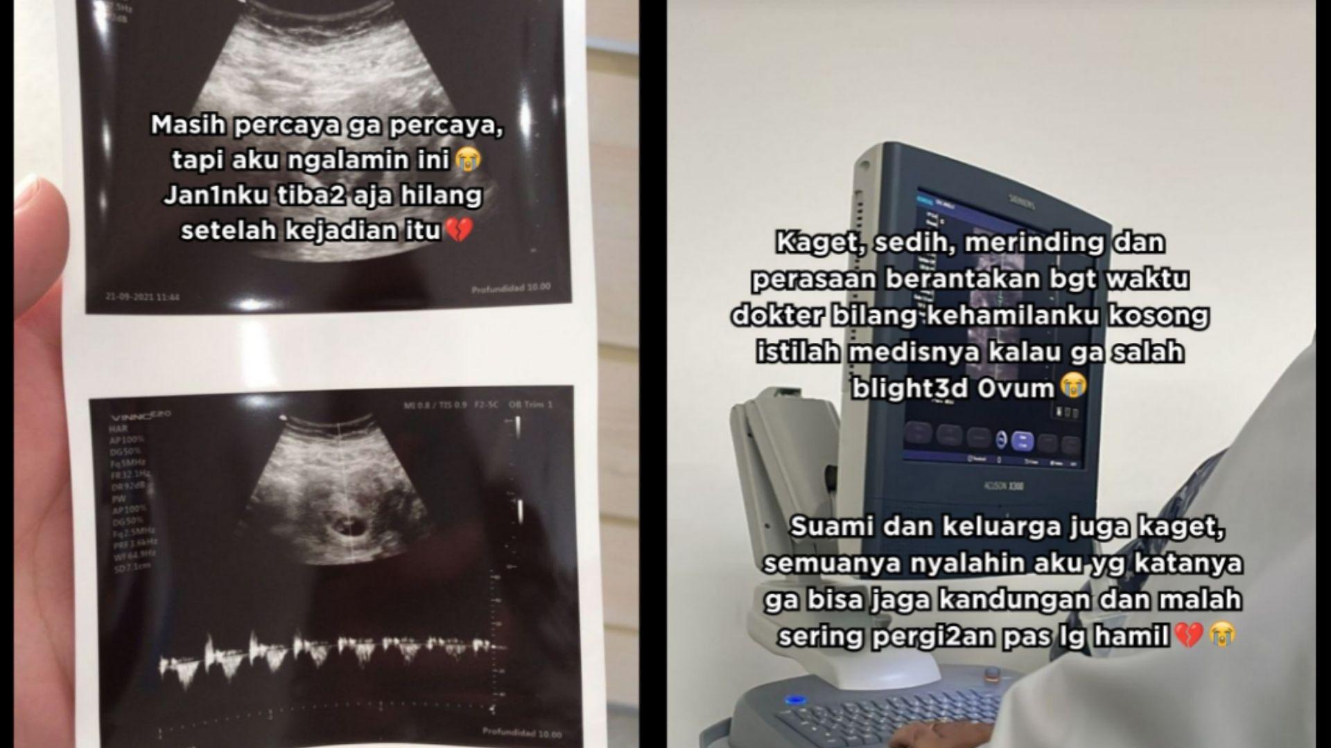 Heboh Wanita Muda Kehilangan Janin Usai Bantu Nenek-nenek Saat Jelang Magrib