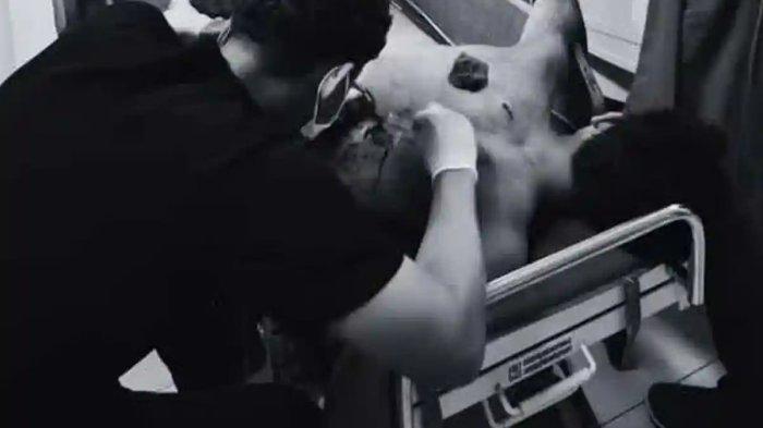 Kronologi Pria di Cileungsi Bogor Dibacok Orang Tak Dikenal, Pelaku Kabur Usai Warga Berkerumun