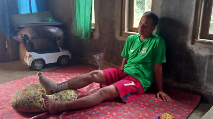 KORBAN JALAN BERLUBANG -- Dedi Permadi (48), korban jalan berlubang harus mendapatkan perawatan setelah terjadi di Jalan Raya Kemang-Parung, pada Jumat (30/1/2026) lalu. Kaki kanan Dedi retak akibat terjatuh dari motor saat melindas jalan berlubang.