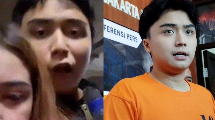 Leon Dozan Sangar Hina Polri Saat Aniaya Rinoa Aurora, Kini Gugup Sampai Salah Ngomong : Saya Hilaf