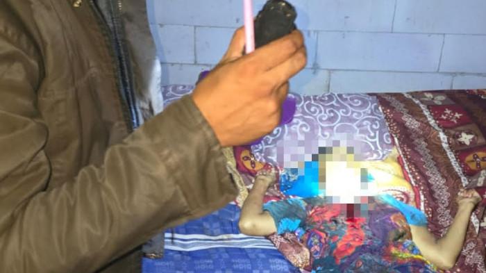 Ditemukan Tewas dengan Leher Tersayat, Wanita di Jonggol Bogor Diduga Akhiri Hidup Sendiri