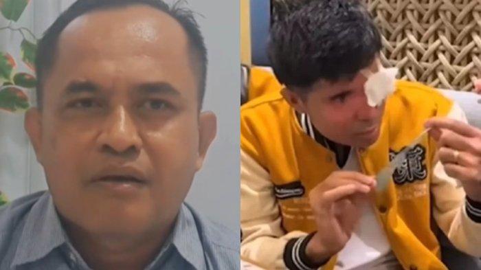 Dibongkar Mantan Pengacara, Agus Salim Disebut Cuma Prank Soal Kondisi Mata : Dia Bisa Lihat