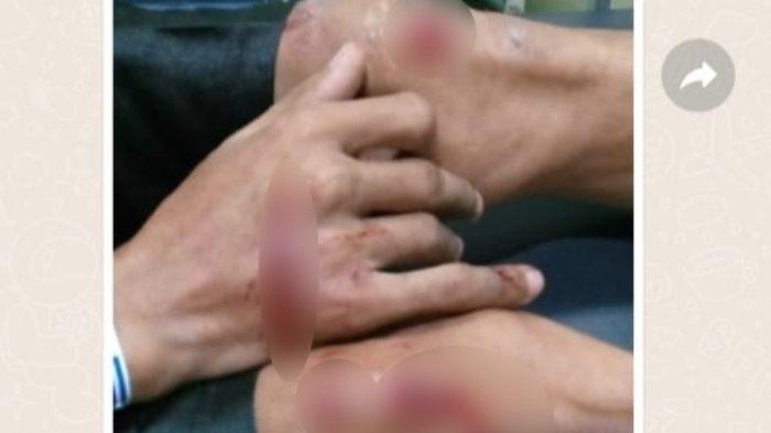 Seorang Pria di Kota Bogor Diduga Diserang Gengster, Korban Disabet Senjata Tajam di Dalam Gang